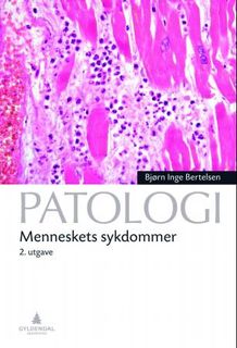 Klikk for å bestille